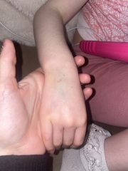 My daughter is really tired after a blood test