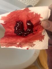 Warning post inc photo - period clots