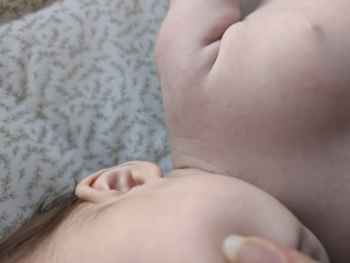 Rash day after 12 week vaccinations?