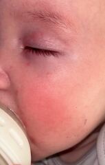 Does this look like a normal baby rash?