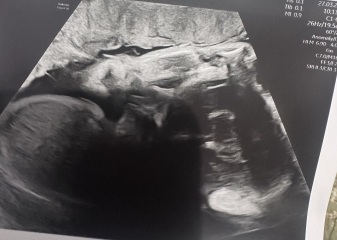 Guessing gender