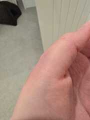 Mystery - Thumb went black