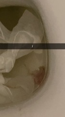 Is this my mucus plug ???? 🆘 34 weeks 5 days