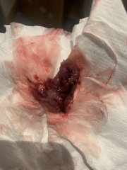 *GRAPHIC* Is this a miscarriage?