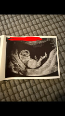 12 weeks Gender Guess