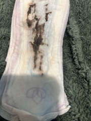 Spotting - brown discharge