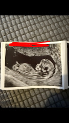 12 weeks Gender Guess