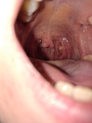Would you worry about this?