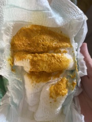 Baby poo - advice! CMPA?