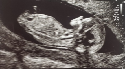 GENDER PREDICTIONS💖💙
