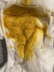 Baby poo - advice! CMPA?