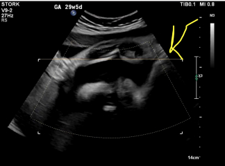 29 week gender confusion? Thoughts?