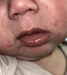 Does this look like a normal baby rash?