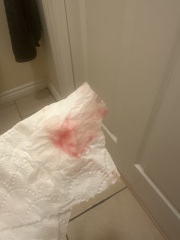 Light Bleeding and cramps on and off
