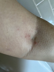 What is this?