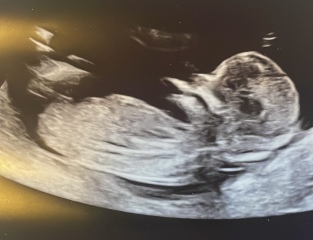 Nub? Is there no nub? Anyone got any guesses