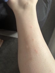 Bed bugs or fleas