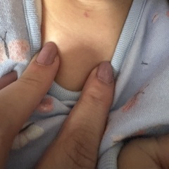 What could this mark be on my one year old?