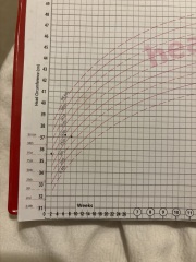 microcephaly? When to worry?