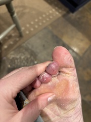 Anyone want to try and diagnose me since doctors can’t?