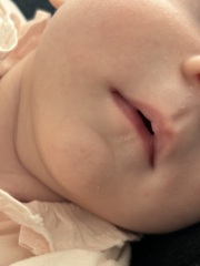 Does this look like a cold sore?