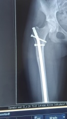 To ask if my daughters xray looks 'normal'?