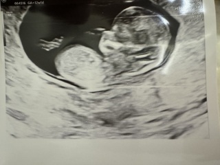 Visible nub? 12 weeks