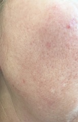 Please help me with this awful skin