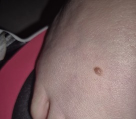 Mole