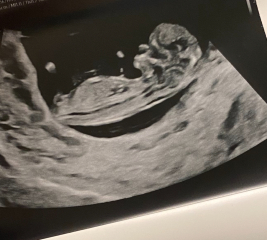 Boy or Girl Guesses