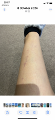 Spots on knee