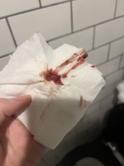 Would you class this as day 1 of period?