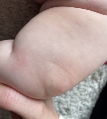 What are these spots?