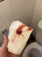 Would you class this as day 1 of period?