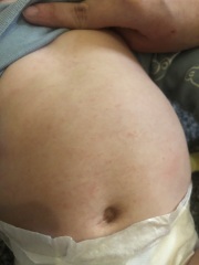 6 month old has red spots ? What are these spots??