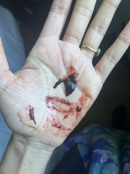 Is this a miscarriage? 7.5 weeks :(