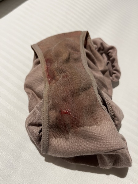 Scared - spotting and small bloody discharge
