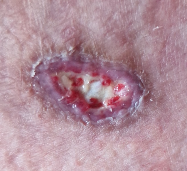 Random raw skin thing - ideas?