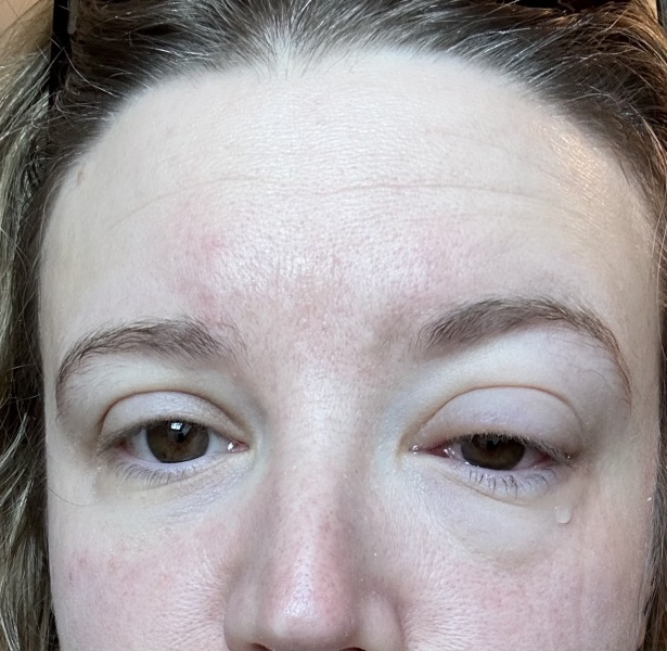 Conjunctivitis for a week, what do I do?