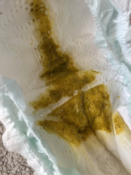 Allergy poop? Photo attached (sorry!)