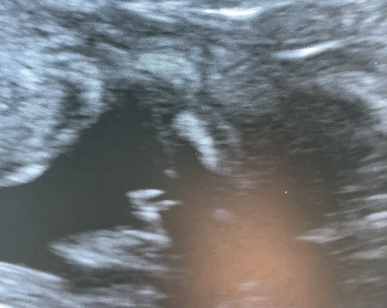 Potty shot confirmation please