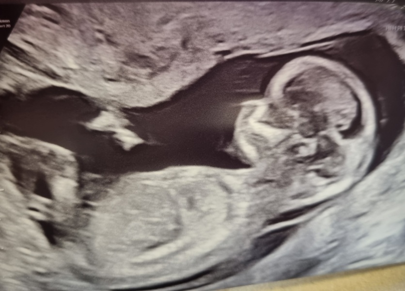 Guess the gender?!