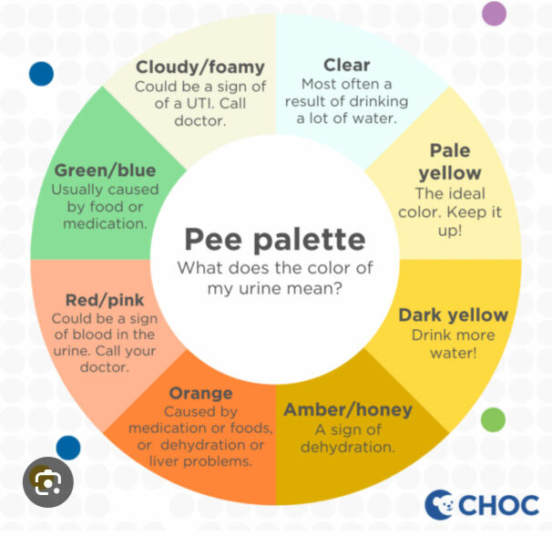 Toddler urine dark? Dehydrated?