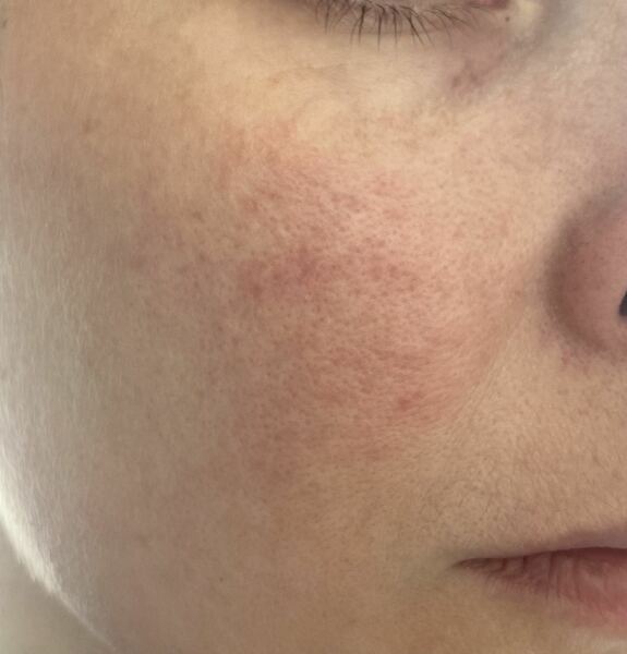 Please help me with h my skin - photo
