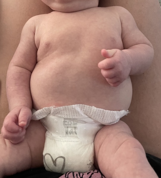 Warning poo picture - does this look like CMPA?