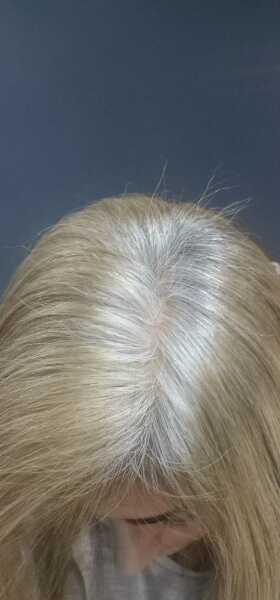 Hair Botox and other treatments not working on my hair