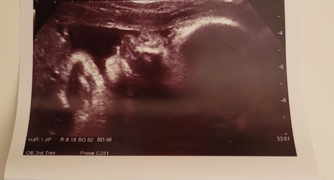 Is it worth getting a photo at the 36 week scan?