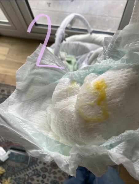 Weird poo and tummy problems (WARNING PICTURES)