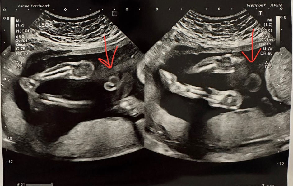 Is this a boy on scan photo?