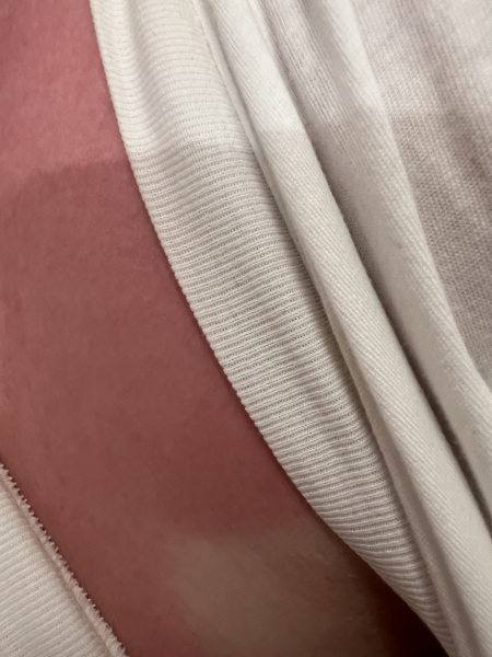 Sunbed Shock